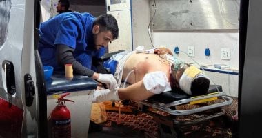 سى إن إن: الأطباء فى غزة ينهارون جوعا.. وسقوط اثنين منهم خلال إجراء عمليات