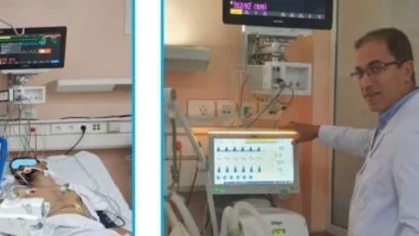 تفاصيل جديدة تُعلن عن أول جهاز تنفّس صناعي مصري محلي الصنع