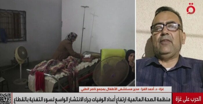 كارثة سوء التغذية تواجه أطفال غزة في مجمع ناصر الطبي