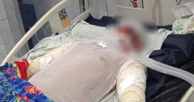 وفاة بطل حريق شبرا الخيمة متأثرا بإصاباته بحروق فى جميع أنحاء جسده